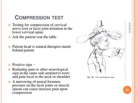 jack's compression test|positive cervical compression test meaning.